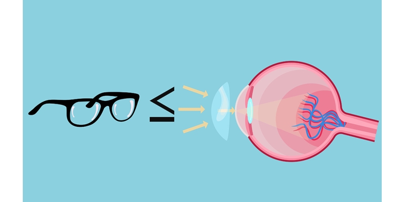 מה היתרון של עדשות מגע על משקפיים?